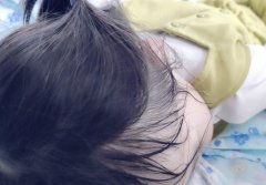 小孩咳嗽吃什么好的快，五个建议参考
