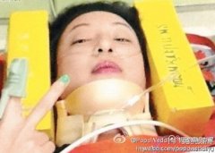 郑希怡发生什么意外，曾被树枝从背部贯穿肺部
