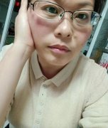 断崖式衰老什么意思，是什么原因，怎么补救