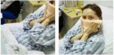 女孩整容太美遭暴打  打人者曾整形失败