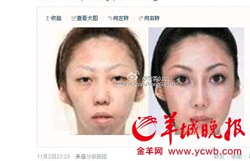 【假新闻3】男子因女儿太丑告妻子整容获赔75万