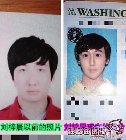蛇精男刘梓晨整容前长什么样?刘梓晨是怎么走红网络的