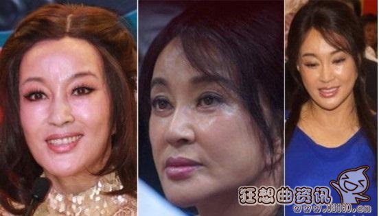 整容女最终只能活在自拍里，整容真的会有后遗症吗