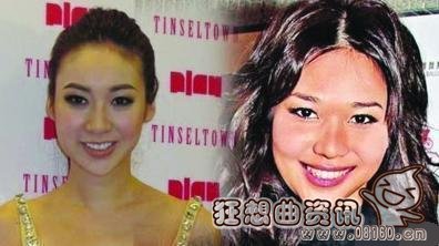 整容女最终只能活在自拍里，整容真的会有后遗症吗