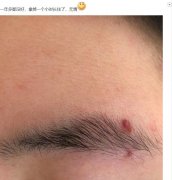 眉钉摘下来还能戴上吗？眉钉早晚都会豁开是吗？
