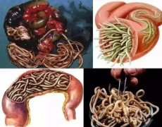 寄生虫长什么样子图片，人体有多少种寄生虫？