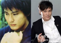 张信哲为老婆疯狂整容？张信哲整容前后照片对比图