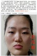 苦瓜脸的女人是否命苦，苦瓜脸怎么可以改善？