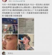猪有蹄前男友叫什么？猪有蹄以前的男朋友是谁？