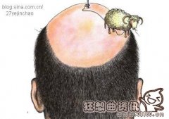 父亲秃顶儿子一定会秃顶吗?秃顶是什么原因造成的?