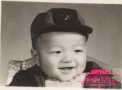 李亚鹏小时候是兔唇吗？兔唇是什么原因造成的遗传吗?