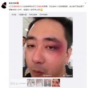 王自健被老婆打是真的吗？他的前妻是学散打的真的假的